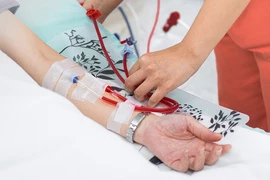 Dùng màng bụng thay màng lọc ở bệnh nhân chạy thận