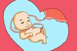 Nguyên nhân gây dây rốn quấn cổ thai nhi 