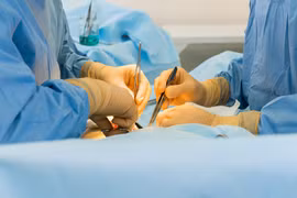 Loại bỏ khối u quái, kích thước lớn cho bệnh nhi 8 tháng tuổi