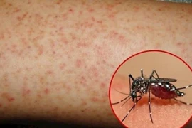 Hà Nội đang có bao nhiêu ca mắc sốt xuất huyết?