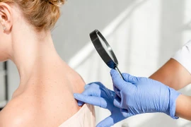 Phòng khám chuyên khoa Da liễu trực thuộc Cty TNHH ST.Paul bị phạt 147 triệu đồng