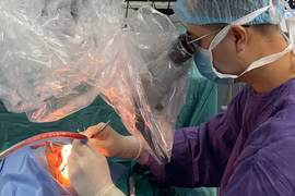 Thanh niên 21 tuổi chít hẹp hoàn toàn ống tai ngoài sau chấn thương