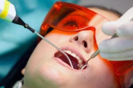 Nữ sinh chết thảm sau khi nhổ răng khôn