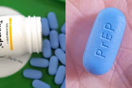 Thuốc kháng virus dự phòng lây nhiễm HIV