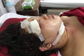 Chồng đánh vợ nhập viện rồi treo cổ chết tại nhà