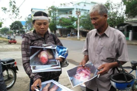 Bộ mặt thật chốn công quyền trong vụ 5 công an dùng nhục hình