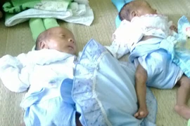 Danh sách bạn đọc ủng hộ 2 bé song sinh suy dinh dưỡng