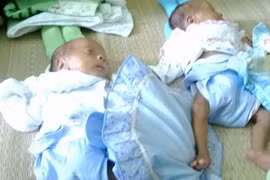 Danh sách bạn đọc ủng hộ 2 bé song sinh suy dinh dưỡng