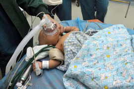 Bé gái 2 tháng bị đâm 3 kim khâu vào người