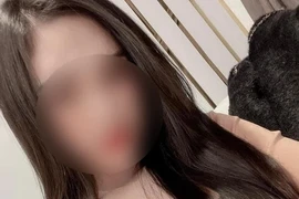 Cô gái sinh năm 2000 tử vong sau phẫu thuật nâng mũi ở Hà Nội 