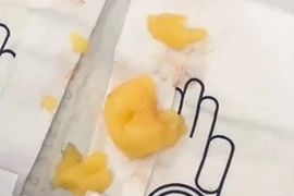 Vỡ òa cảm xúc khi cứu sống được bé trai học thạch rau câu đến tím tái người