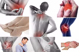 Bác sĩ chỉ rõ nguyên nhân đau nhức toàn thân thường xuyên