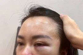 Hà Nội: Vợ bị chồng cũ “bắt cóc” đánh đập dã man