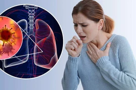 Ung thư phổi chọn xét nghiệm đột biến gen bằng phương pháp nào?