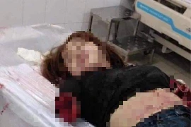 Lời khai của người chống chém đứt lìa 2 cánh tay vợ