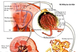 Suy thượng thận do dùng thuốc corticoid chữa dị ứng, viêm khớp