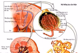 Suy thượng thận do dùng thuốc corticoid chữa dị ứng, viêm khớp