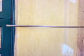 Thanh sắt xuyên hậu môn thủng trực tràng vì trò đùa học sinh