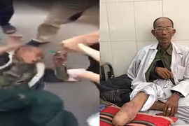 Khởi tố 2 bố con tài xế ôtô đánh thương binh ở Hà Nội