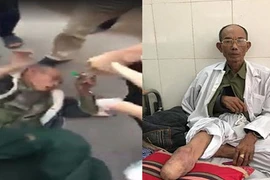 Khởi tố 2 bố con tài xế ôtô đánh thương binh ở Hà Nội