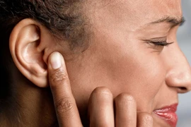 Mẹo chữa ù tai tại nhà nhanh chóng, hiệu quả