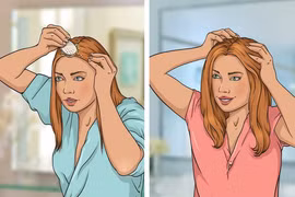 5 cách tự nhiên giúp kích thích tóc mọc nhanh và dày dặn