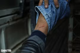 Cán bộ phường bị chó chạy rông cắn chảy máu chân khi vây bắt