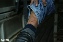 Cán bộ phường bị chó chạy rông cắn chảy máu chân khi vây bắt