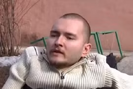 Tiết lộ sốc về ca phẫu thuật ghép đầu người