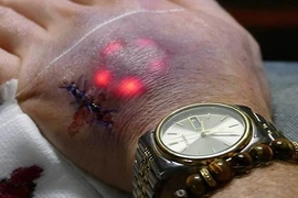 Giới trẻ khoét thịt, cấy đèn LED dưới da rùng rợn
