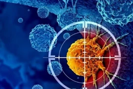 Các nhà khoa học loại bỏ 99% tế bào ung thư bằng kỹ thuật mới