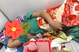 Quảng Nam: Một bé sơ sinh gãy xương đùi khi mổ lấy thai