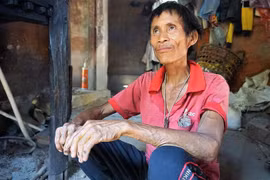 Người rừng Hồ Văn Lang mắc bệnh ung thư gan 