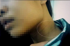 Truy tố đại gia hiếp dâm du học sinh Mỹ ở Sài Gòn