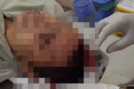 Anh Hùng với thương tích trên người.