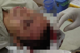 Anh Hùng với thương tích trên người.