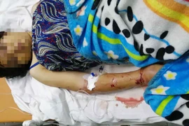 Hai anh em ruột cùng thanh niên tra tấn như thời Trung cổ khiến bà bầu sảy thai ở Sài Gòn.