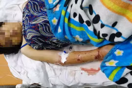 Hai anh em ruột cùng thanh niên tra tấn như thời Trung cổ khiến bà bầu sảy thai ở Sài Gòn.