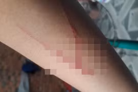 Bé gái trong vụ án hiếp dâm ở Sài Gòn 'bịa' thông tin bị 2 thanh niên chém 