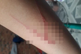 Bé gái trong vụ án hiếp dâm ở Sài Gòn 'bịa' thông tin bị 2 thanh niên chém 