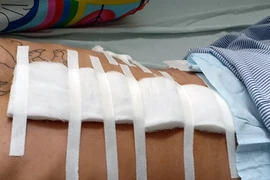 Hình minh hoạ. Ảnh: Internet