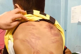 Khởi tố người cha bạo hành con gái ruột 6 tuổi nhiều lần ở Miền Tây 