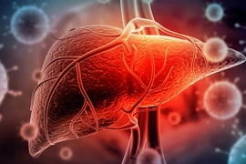 Các bệnh ung thư liên quan trực tiếp đến rượu bia