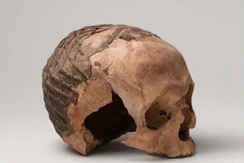 Tìm thấy đầu lâu bọc nhựa đường 9.000 tuổi, chuyên gia sững người 