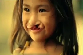 Nụ cười bé gái hở hàm ếch trong thước phim cảm động