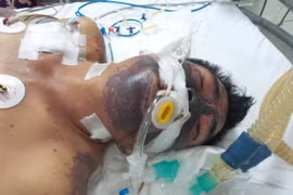 Mất Tết vì... bát tiết canh