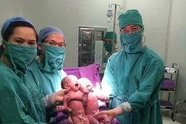 Sinh đôi cùng trứng ra đời nhờ phương pháp thụ tinh ống nghiệm