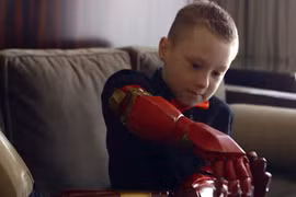 Em bé khuyết tật 7 tuổi được lắp cánh tay siêu nhân