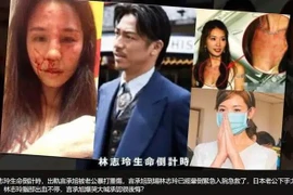 Không thể sinh con, Lâm Chí Linh bị chồng bạo hành