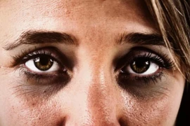 4 thứ này thâm đen... dễ mắc bệnh nguy hiểm, có 1 cũng nên đi khám